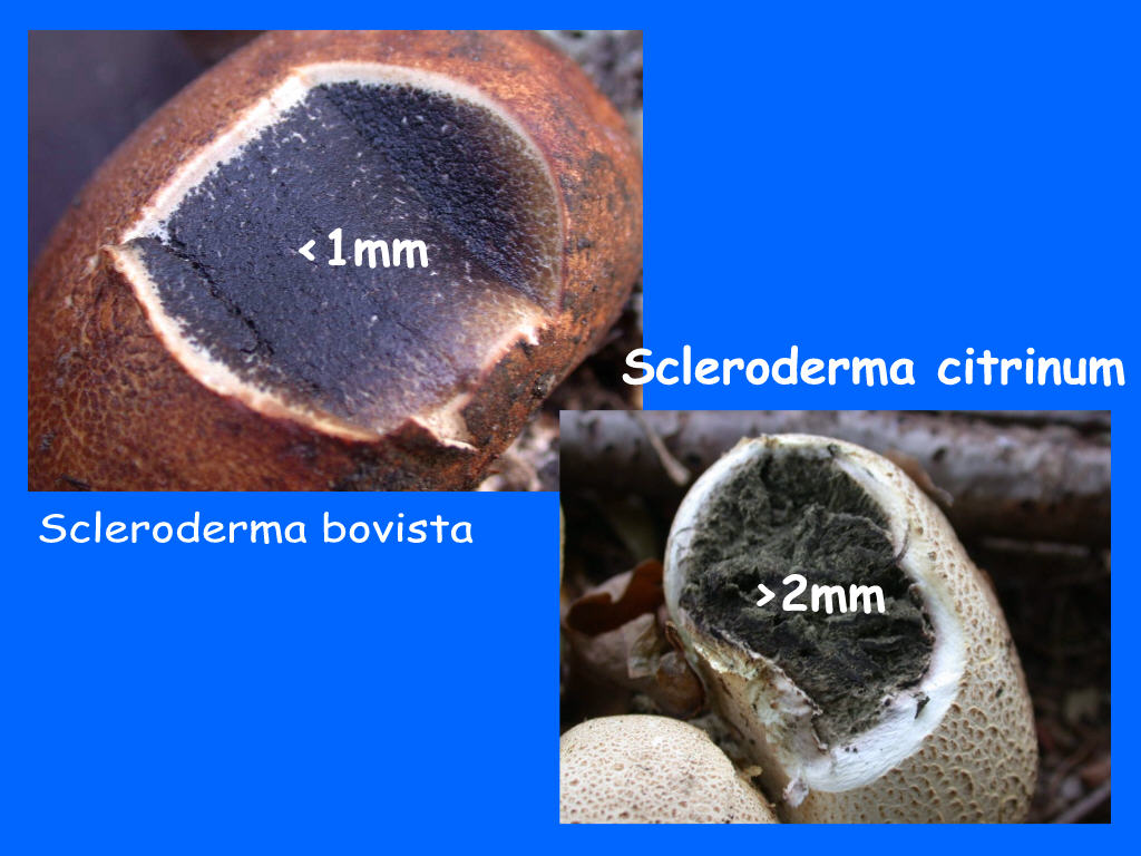 Si fa presto a dire Scleroderma....